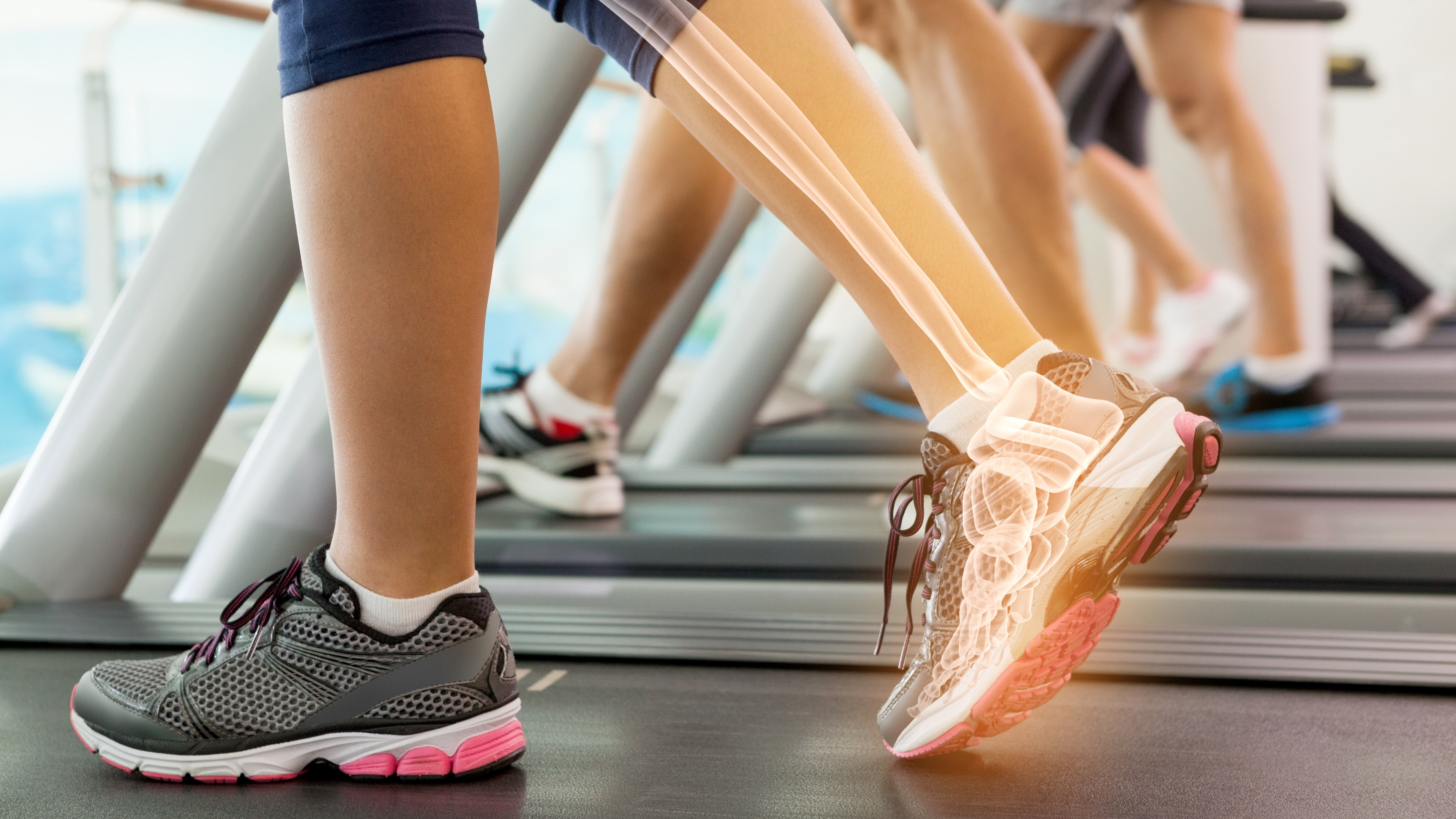 Dramatized photograph of runners on treadmills, foot and ankle bones can be seen